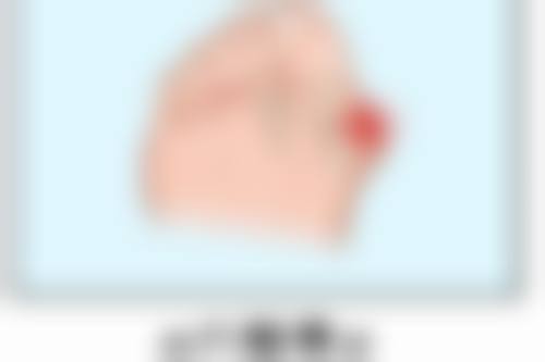 1.55万的手术到底咋做的