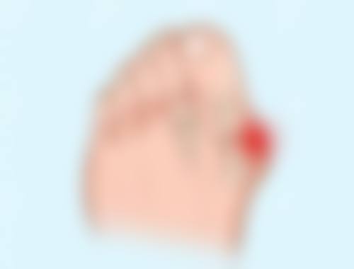 深圳富华整形注射整形 9780 元真实评价反馈