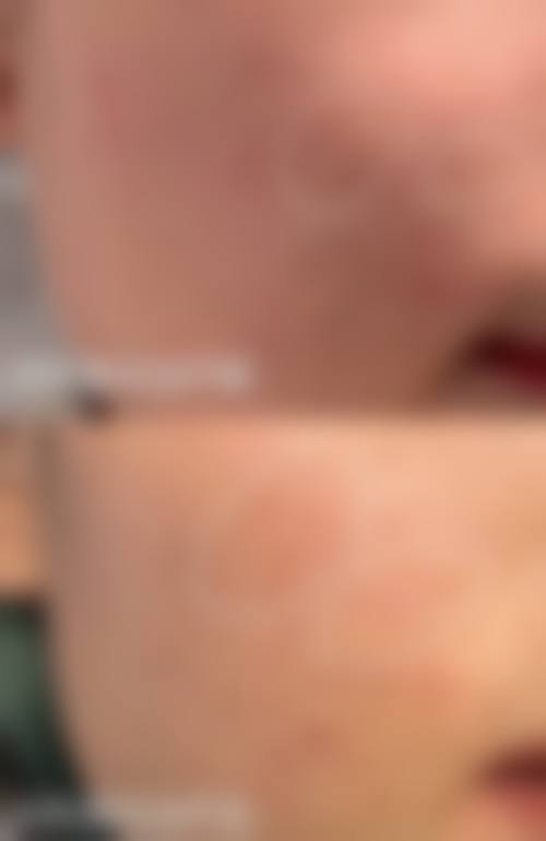 六、上海市东方医院整形美容科怎么预约：