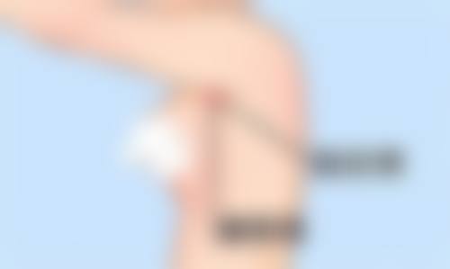 为啥选深圳今喜和曹孟君医生