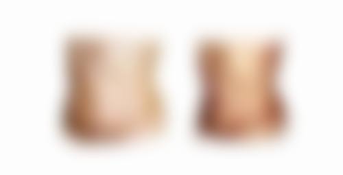 五、上海市东方医院整形美容科实例