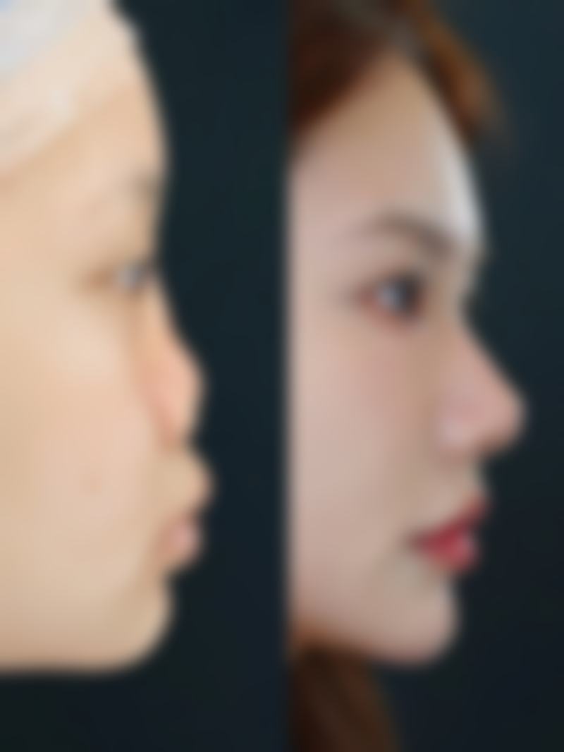 7D聚拉提：开启美丽新时代的理想之选