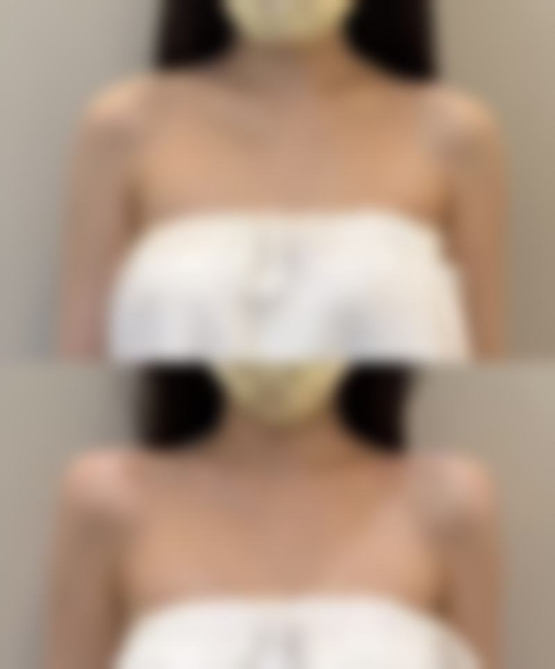 赵厉面部整形实例