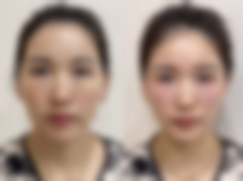 惊艳成效，我太满意啦