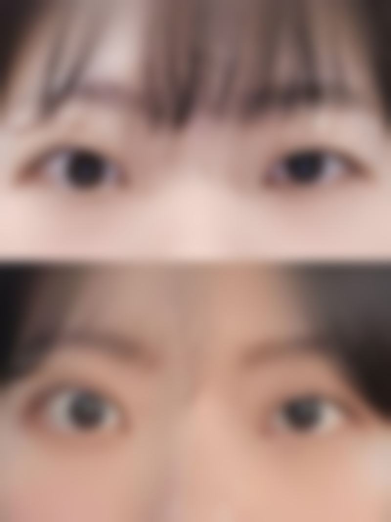 赵厉面部整形水平怎么样可靠吗？