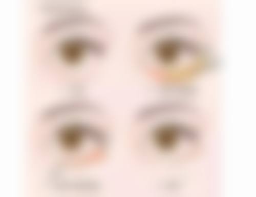 六、天门忆美医疗美容诊所价格表：（仅供参考）