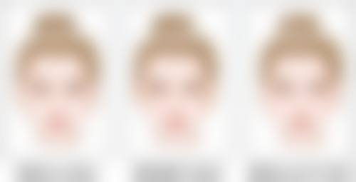 五、新生植发国内连锁（昆明分店）实例