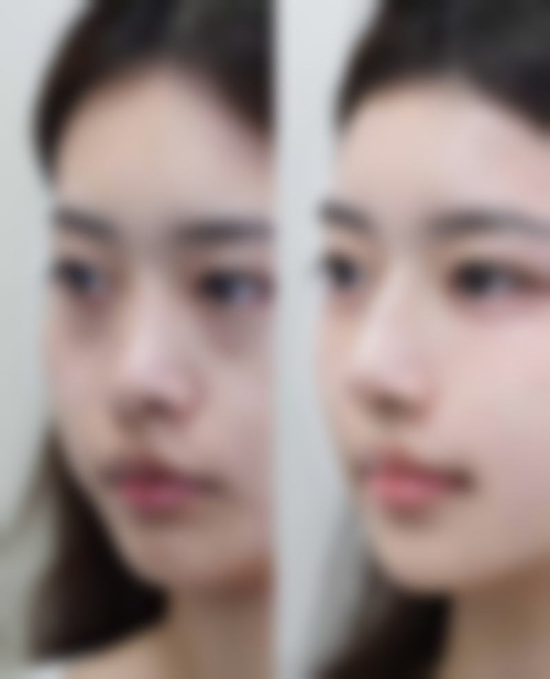 七、长葛驻颜华宇医疗美容诊所真实的顾客评价如下：