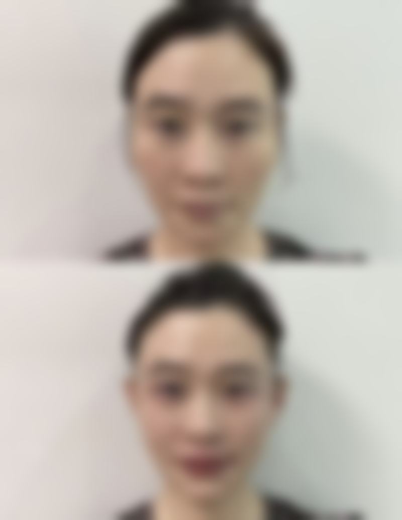 四、黑龙江哈尔滨再生医美整形医院实例