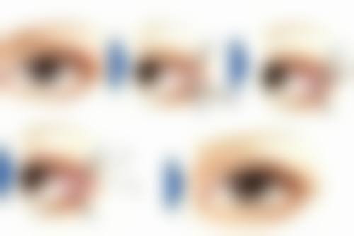 五、叶城新一美整形医院怎么预约：