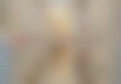 王业炜眼部整形实例