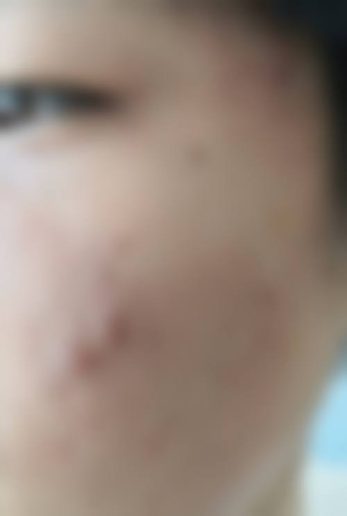 张玉芬项目价格表参考