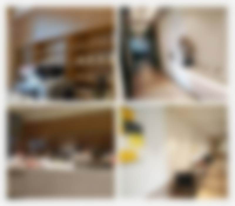 吴清娟膨体垫下巴实例