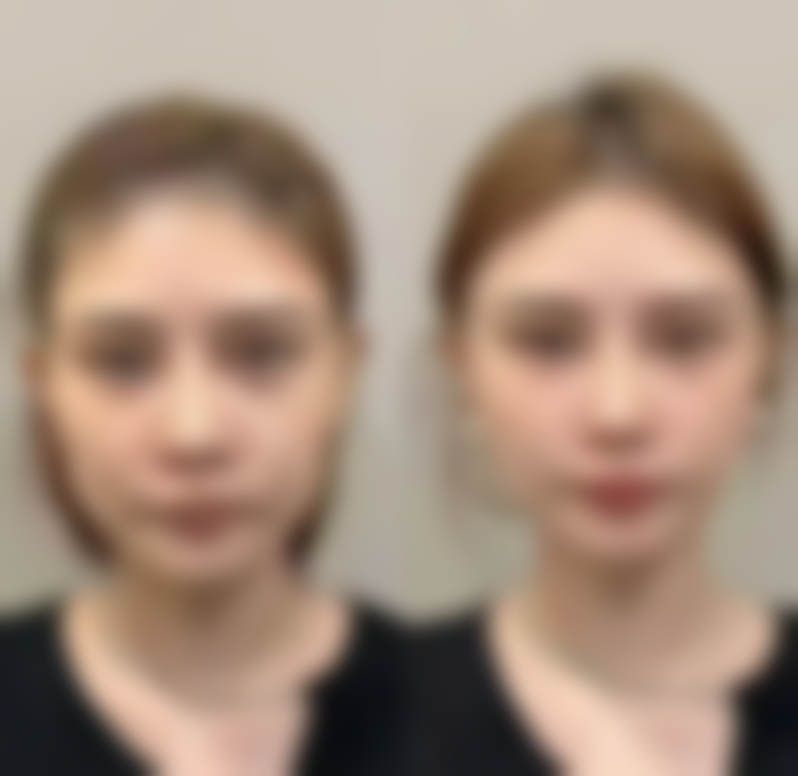 姚玲项目价格表参考