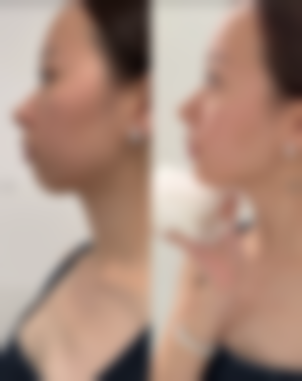 姚玲在哪家医院