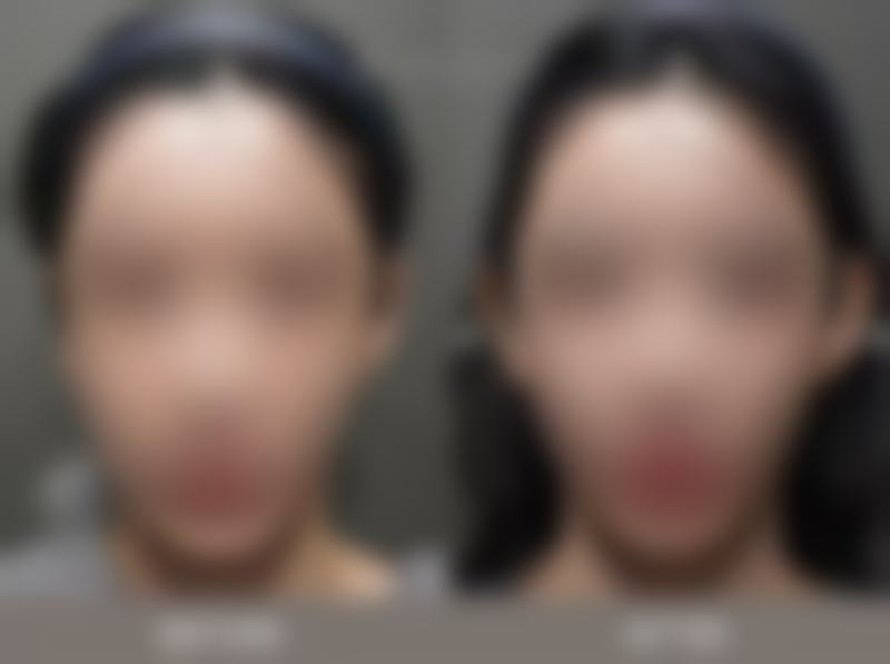 四、北京华臣医疗美容实例