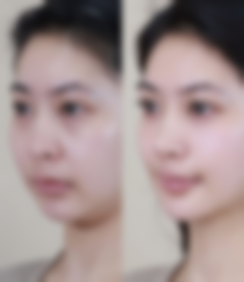 六、北京华臣医疗美容价格表：（仅供参考）