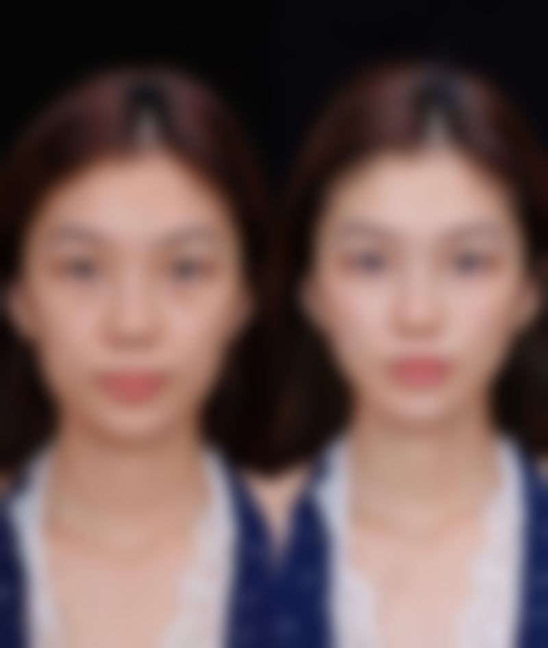 七、深圳禾鑫医疗美容门诊部真实的顾客评价如下：