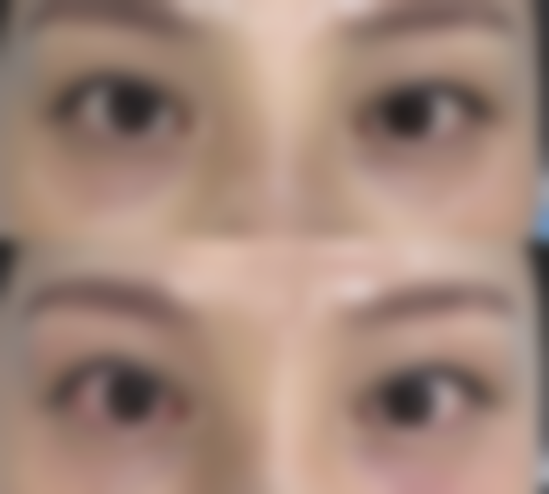 六、保定市前列中 心医院烧伤整形外科怎么预约：