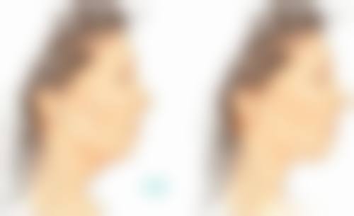 七、济南美辰医疗美容医院价格表：（仅供参考）