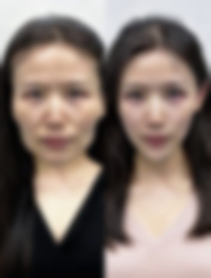 四、深圳瓷美集整形医院实例