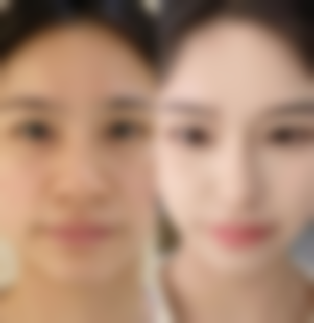 五、泉州东湖整形美容医院怎么预约：