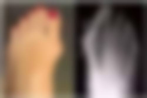 六、北京圣嘉荣整形医院怎么预约：