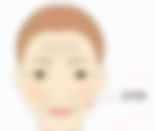 双眼皮拆线后眼角小疙瘩别慌！多途径处理+优质医院助力，轻松消除不是梦 