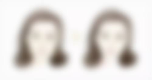 五、银川维多利亚整形美容医院实例