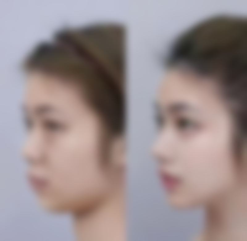 五、珠海美之昂整形医院怎么预约：