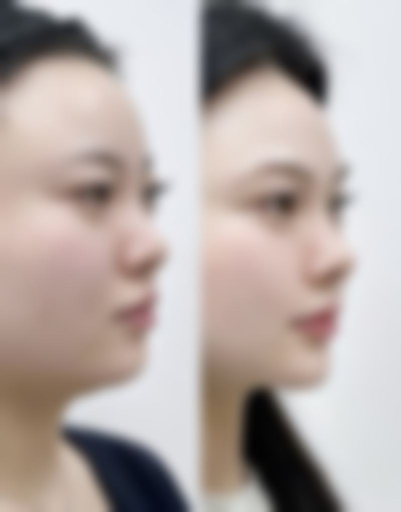 五、山东泰安市雅美口腔门诊部实例