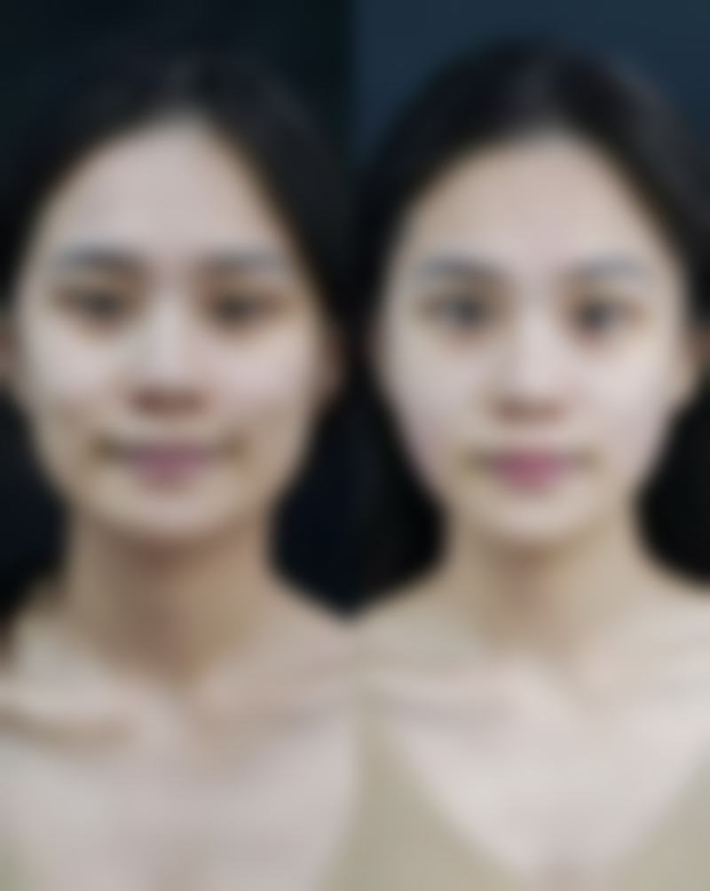 七、内蒙古兴安盟人民医院价格表：（仅供参考）