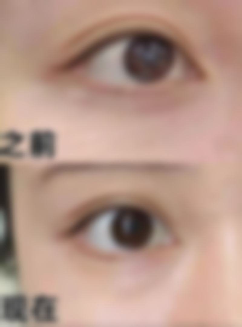 七、珠海美之昂整形医院真实的顾客评价如下：