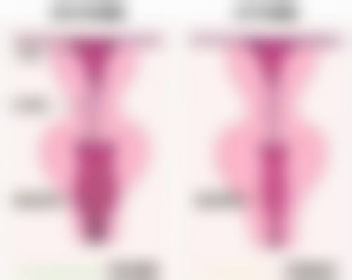 有能去眼袋的眼霜！分型选针对性产品，结合习惯护理改善效果看得见 