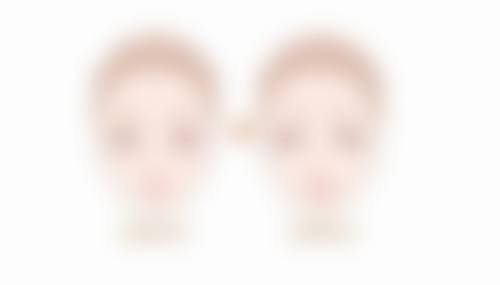 开水烫伤疤痕增生别发愁！医院环境特别贴心