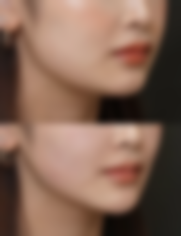 开水烫伤疤痕增生别心焦！医院口碑超良好