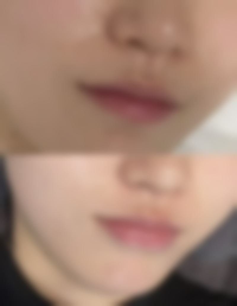 大疙瘩别害怕，手术治疗来帮忙