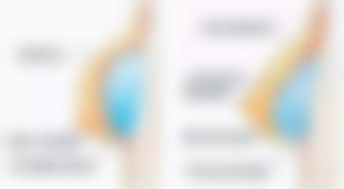 如何打造成效突出的双眼皮？选对医生是关键