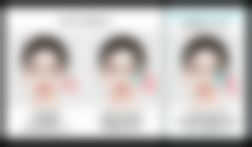 天生的下眼袋怎么长效消除？术后护理不能忘