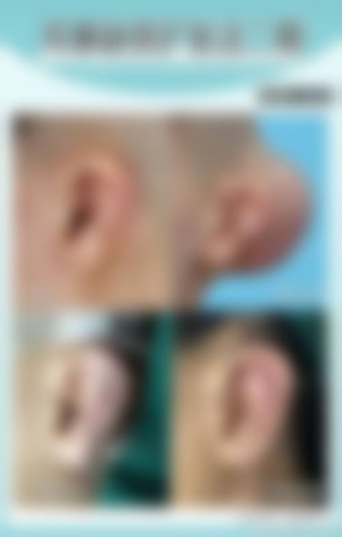 张会堂鼻再造水平怎么样可靠吗？