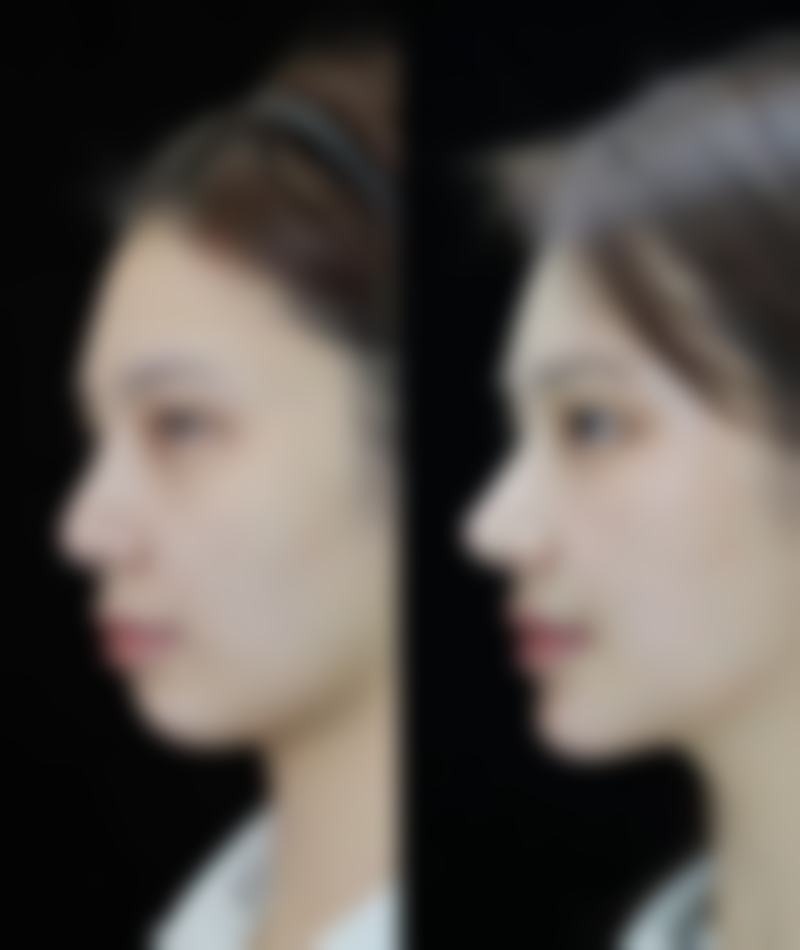 XX医院：专精打造7.5毫米精致双眸！