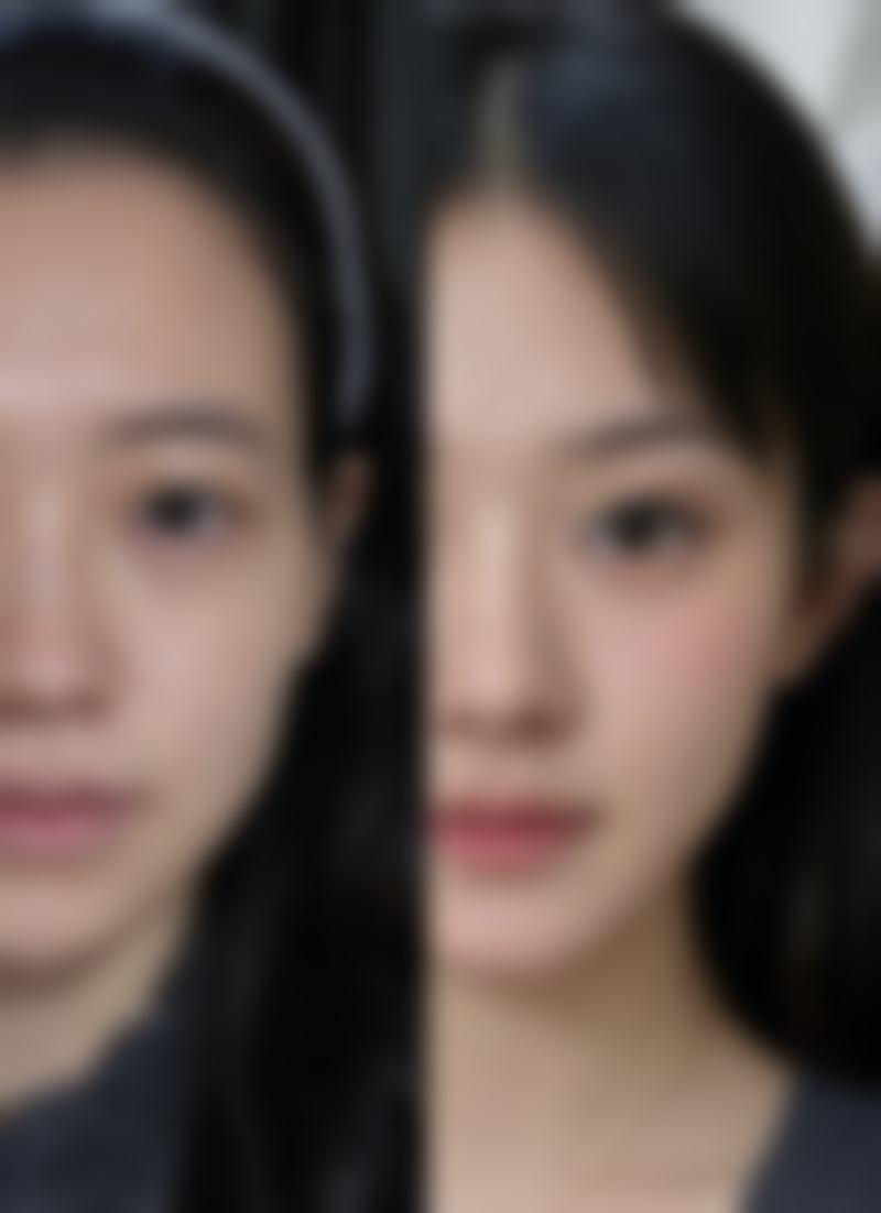 宝宝脸上冻疮疤痕怎么去除？专精医学干预来助力