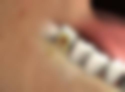 医美手段助力，淡化疤痕更效率高