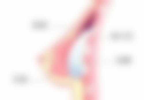 德国热效溶脂去眼袋，微创快速修复靠不靠谱？