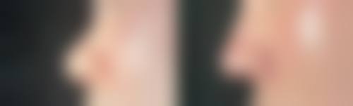 六、成都度曼美医疗美容诊所怎么预约：