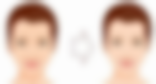 打了瘦脸针后能锻炼吗？掌握运动时机与要点，助你美丽与健康兼得 