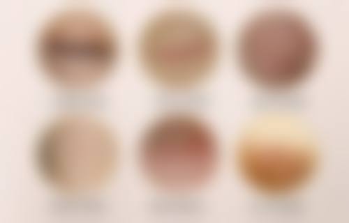 张会堂鼻再造水平怎么样可靠吗？