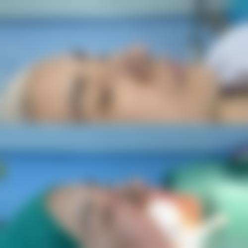 张会堂鼻再造实例