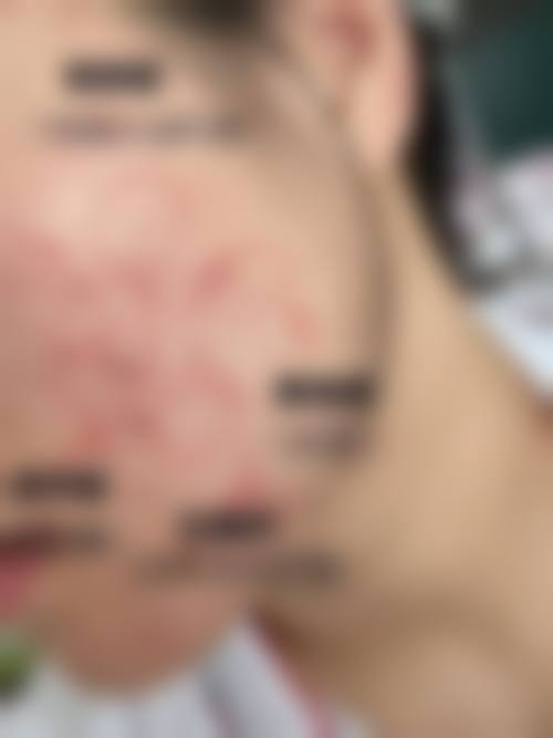 李灵玲怎么预约？