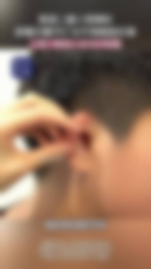 张会堂鼻再造实例